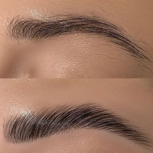 brow bumber